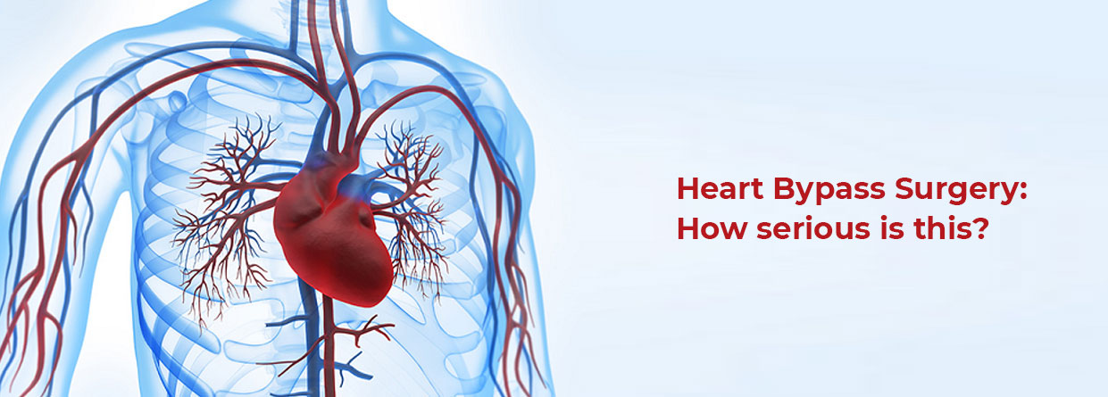 Heart Bypass Surgery: How serious is this?